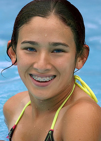 stock photo of girl with braces in the pool